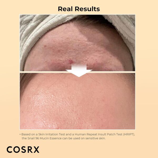 COSRX Snail 96% Mucin Power Repairing Essence 3.38 fl.oz 100ml - Image 2